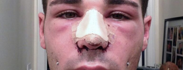 Joey (26) legt sich über 100 Mal unters Messer, um seinen Po zu vergrößern